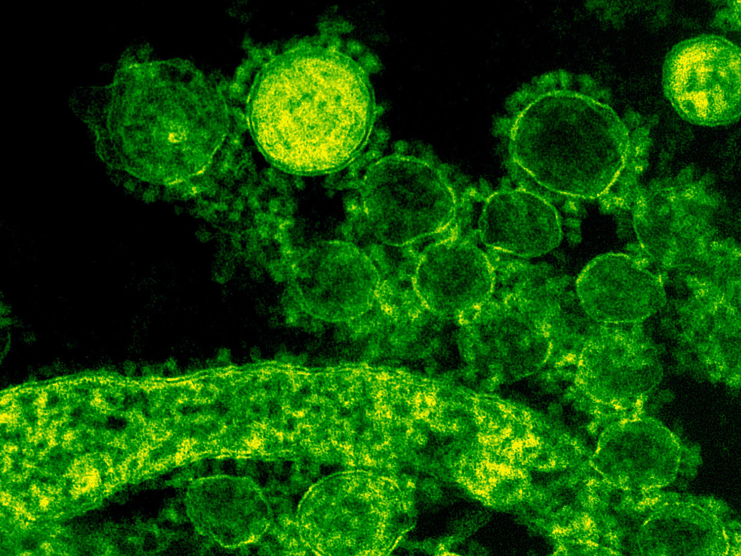 Wie tötet Chlordioxid (ClO2) Bakterien ab?